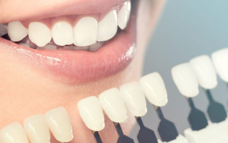 Best Cosmetic Dentist in Vasant Kunj