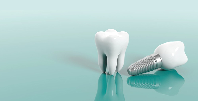 Matrix Dental & Skin Lounge for Your Dental Implants
