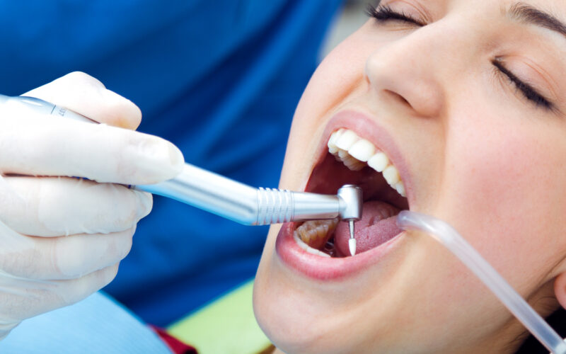 Cost of dental implant in Delhi Matrix Dental Clinic is the Best Dental Clinic in Delhi