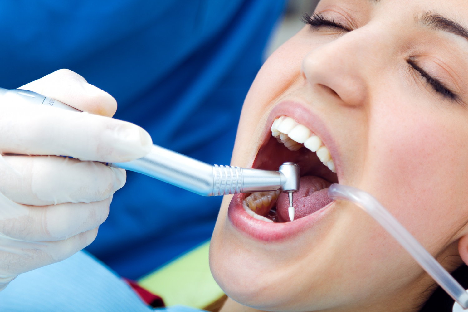 Cost of dental implant in Delhi Matrix Dental Clinic is the Best Dental Clinic in Delhi