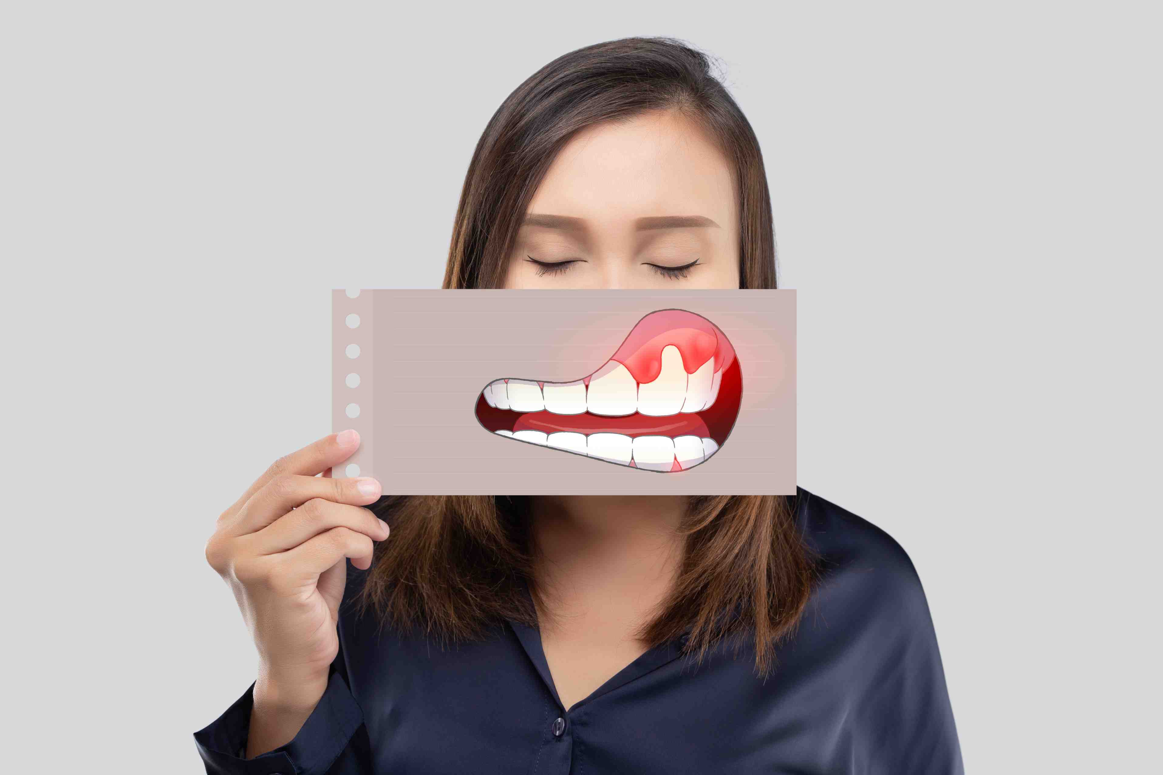 Gum-treatment-in-Delhi-Matrix-Dental