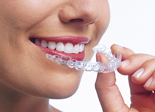 Dental braces in South Delhi